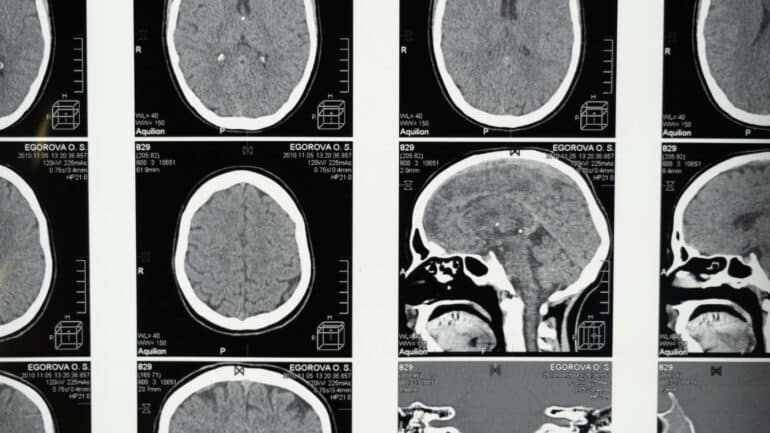 Close up brain scan